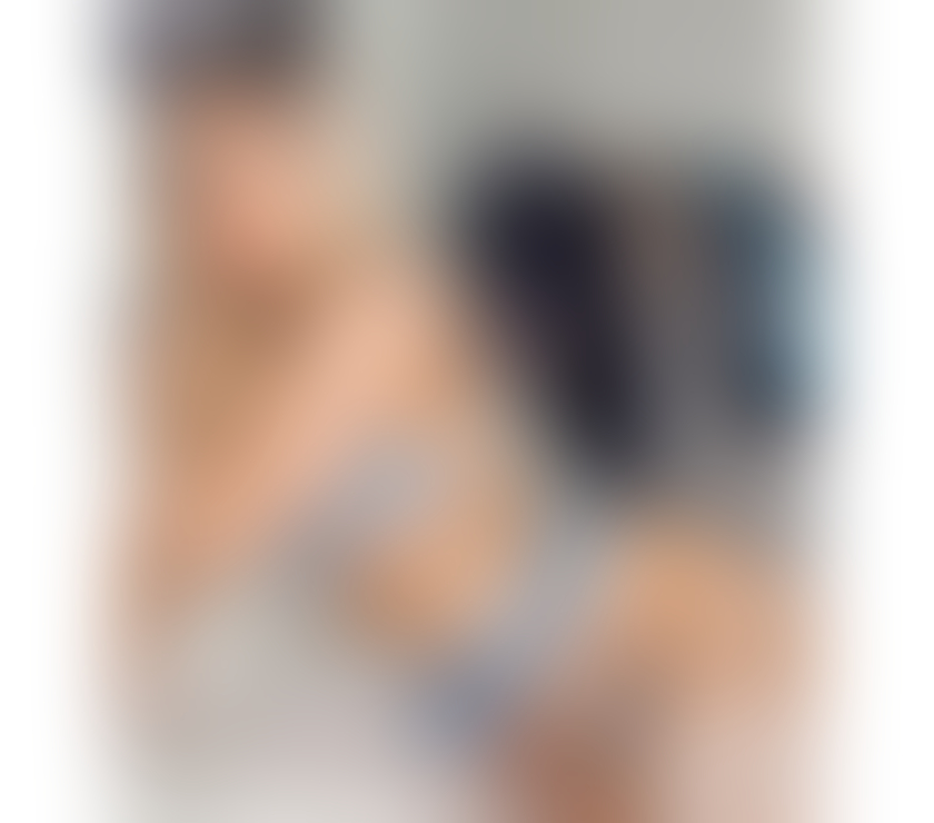 Escorts Edinburgh Edinburgh - Edinburgh - Photos for EMMA🔥 REAL PHOTO INCALL OUT CALL NEW IN TOWN💦